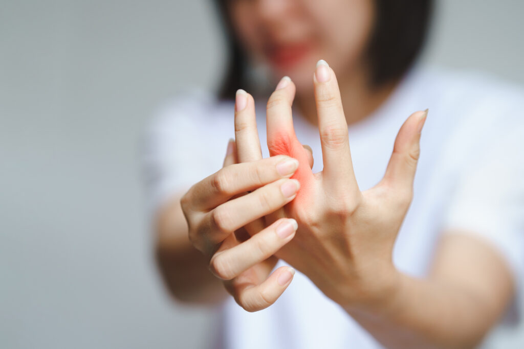 Woman holding her finger in pain, possibly due to a cut, burn, or other injury.