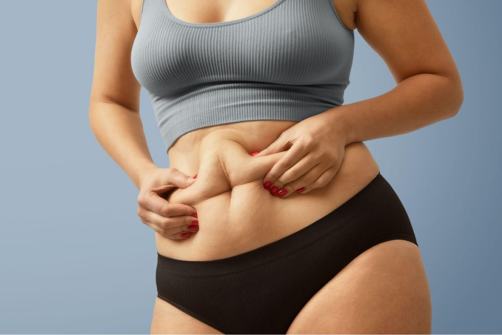 A person holding and pinching their abdominal fat while wearing a sports top and black shorts.